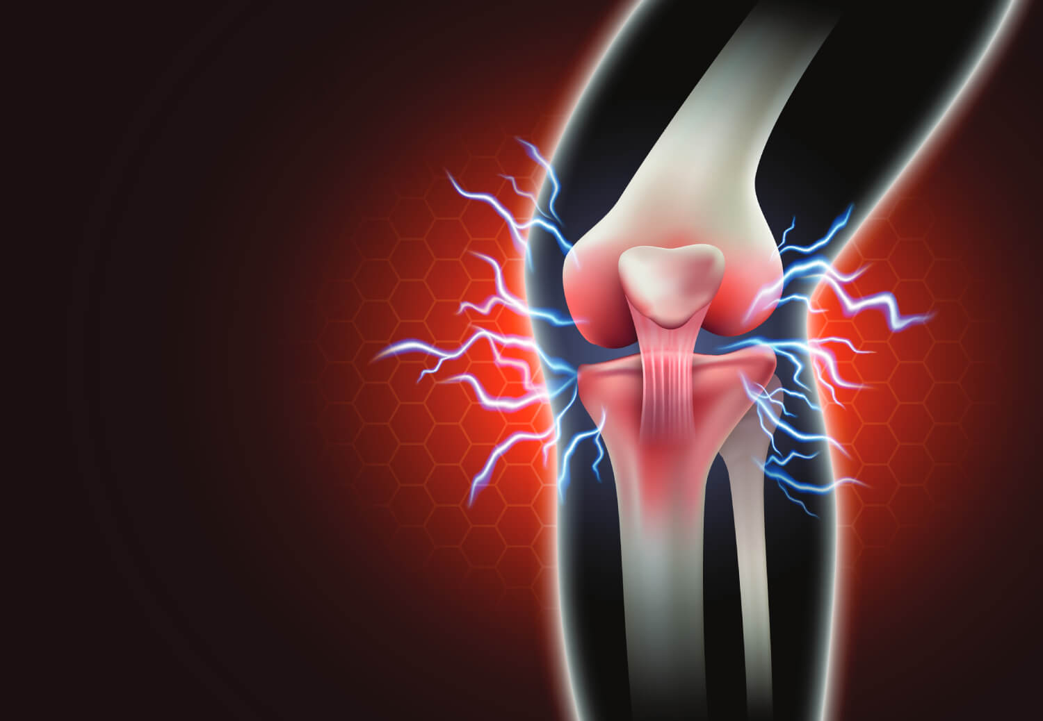 Why Ignoring Joint Pain is Never the Answer